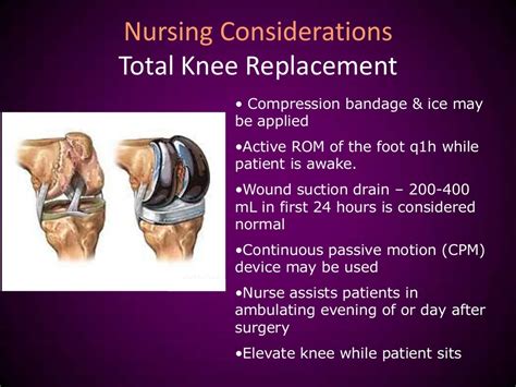 Total knee replacement nursing management .